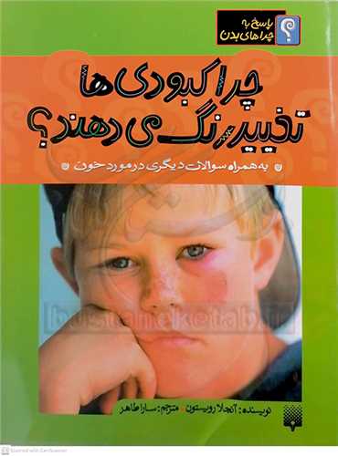 چرا کبودي ها تغيير رنگ مي دهند؟